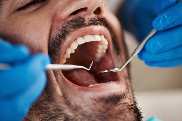 Emergency Dental Services in El Verano, CA